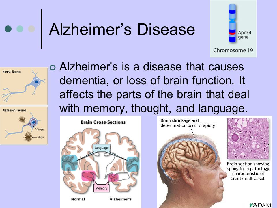 Dementia: Nutrition and Emotional Conditions